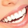 Foto de Odontologia Integral Mansilla-implantes dentales