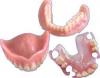 Foto de Protesis dentales flexibles y de acrilico, placas de relajacion y