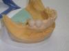 Estetica dental. Laboratorio de protesis dental .