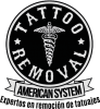Tattoo Removal American System
